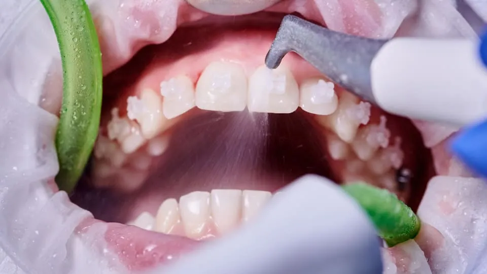 dental-filing-clinic