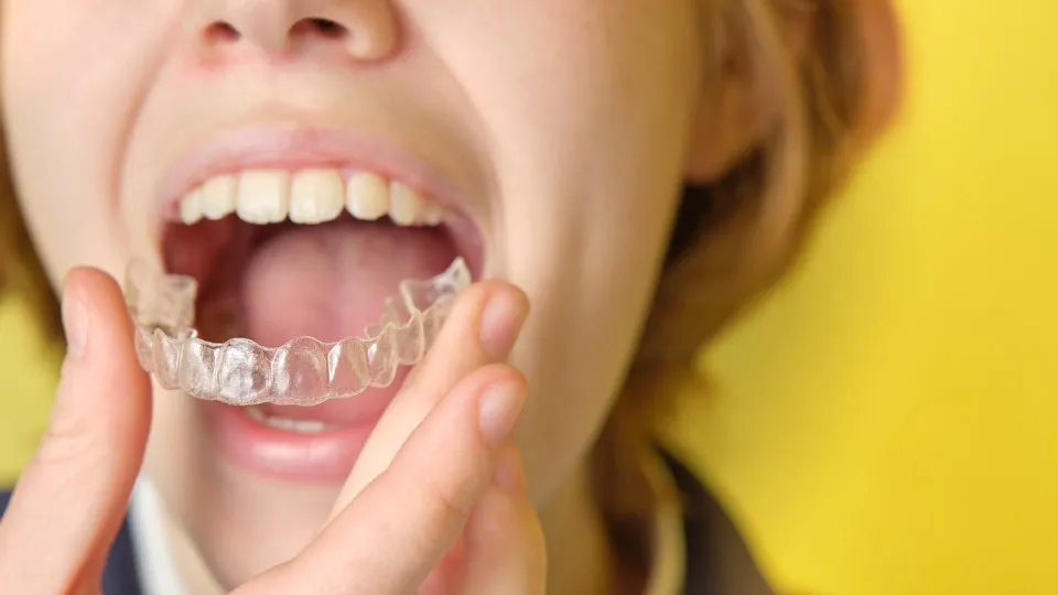 invisalign-Common-Symptoms