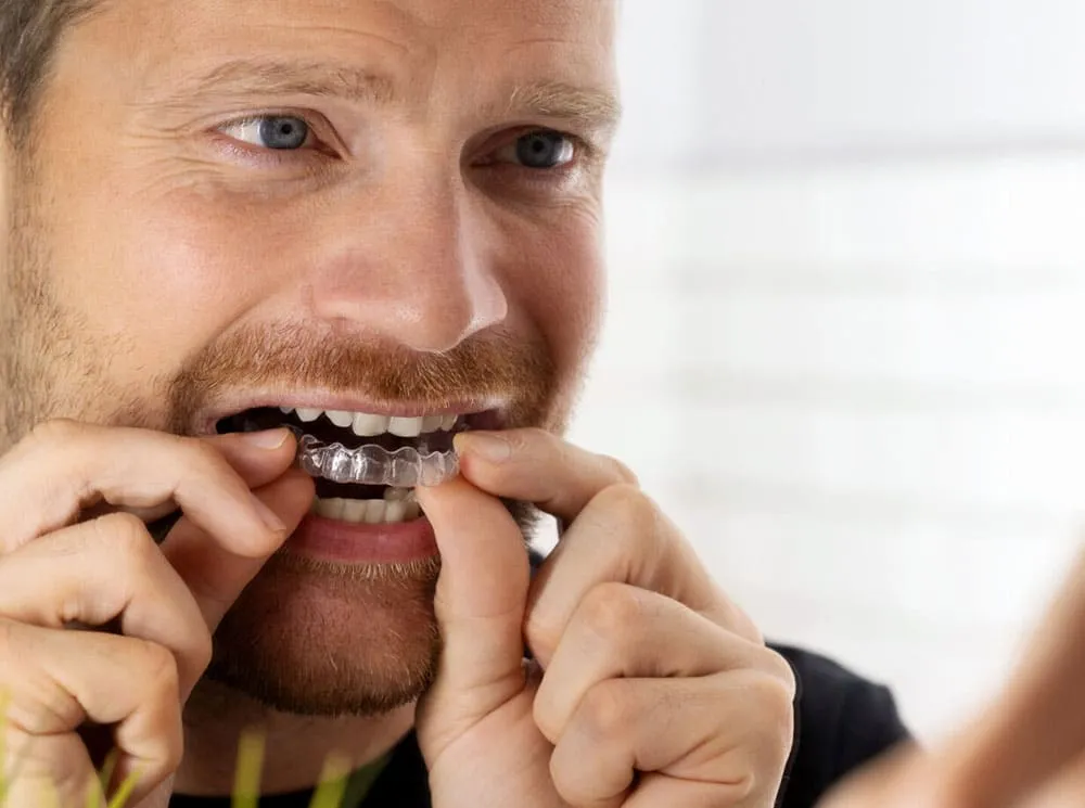 invisalign