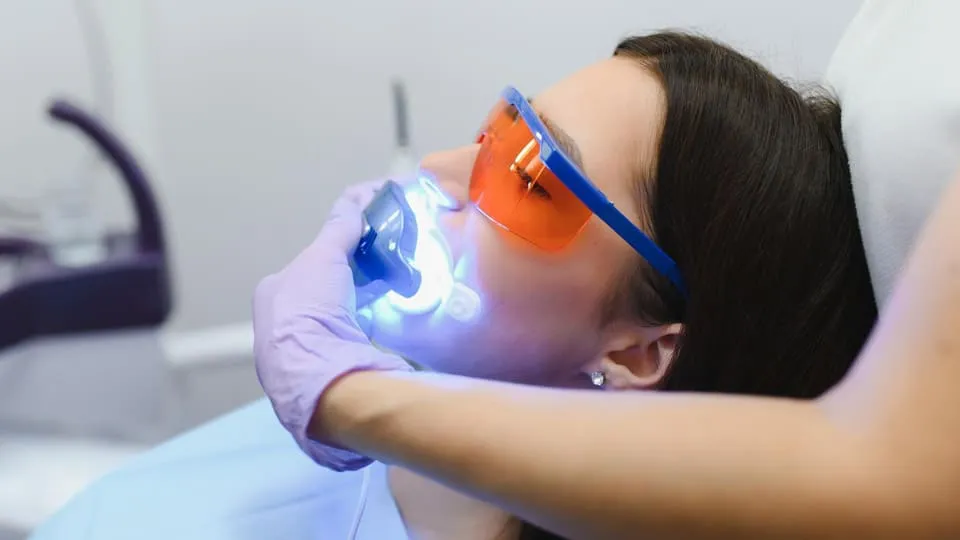 london-dental-clinic-tooth-whitening