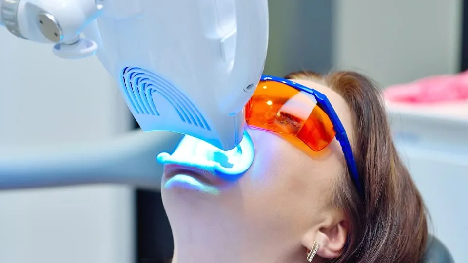 teeth-whitening-london-clinic