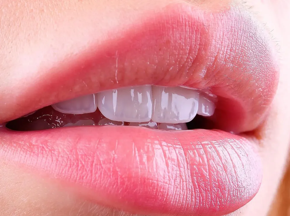 zirconium-crown-teeth